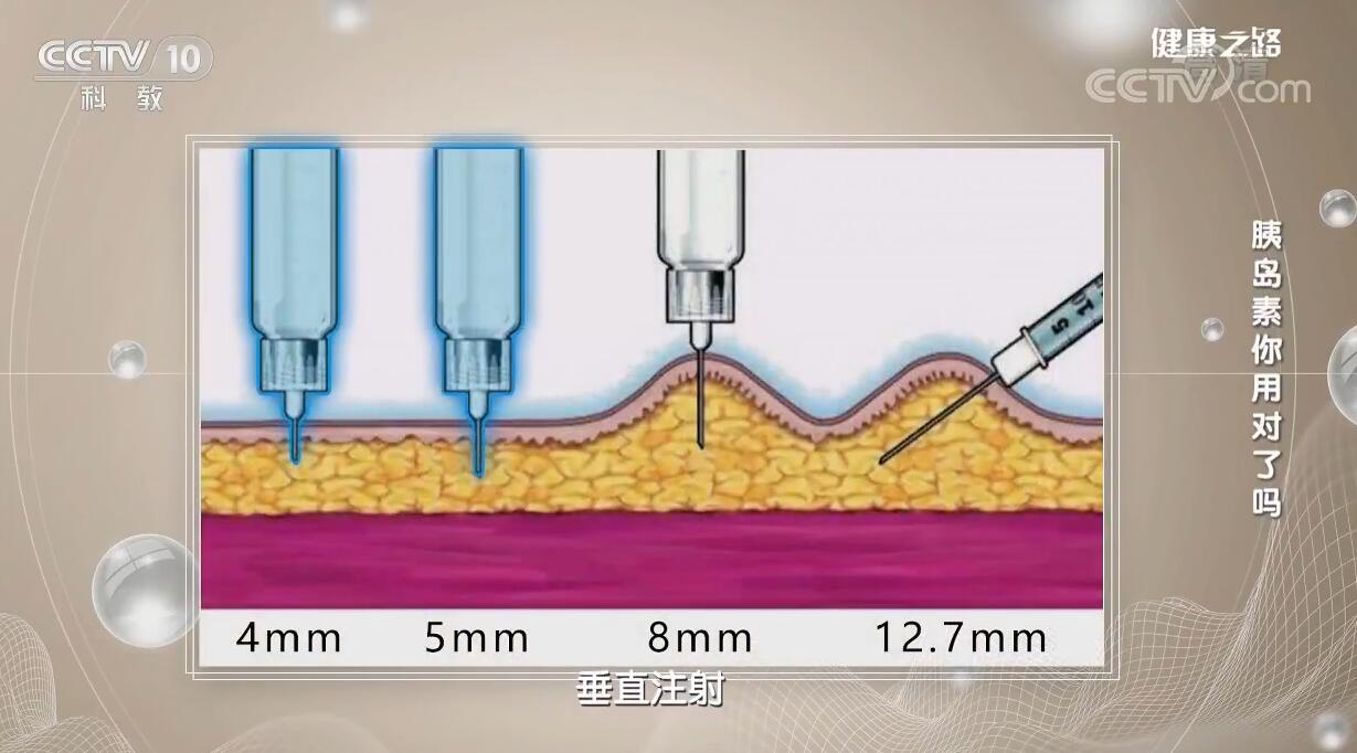 胰岛素针头4mm和5mm有什么区别