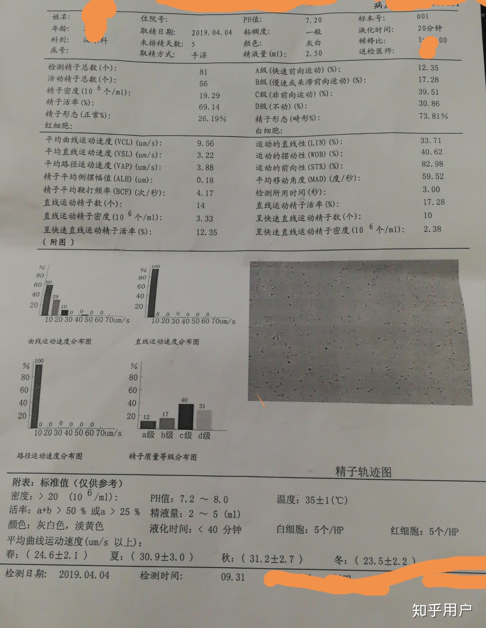 医院怎样取精的