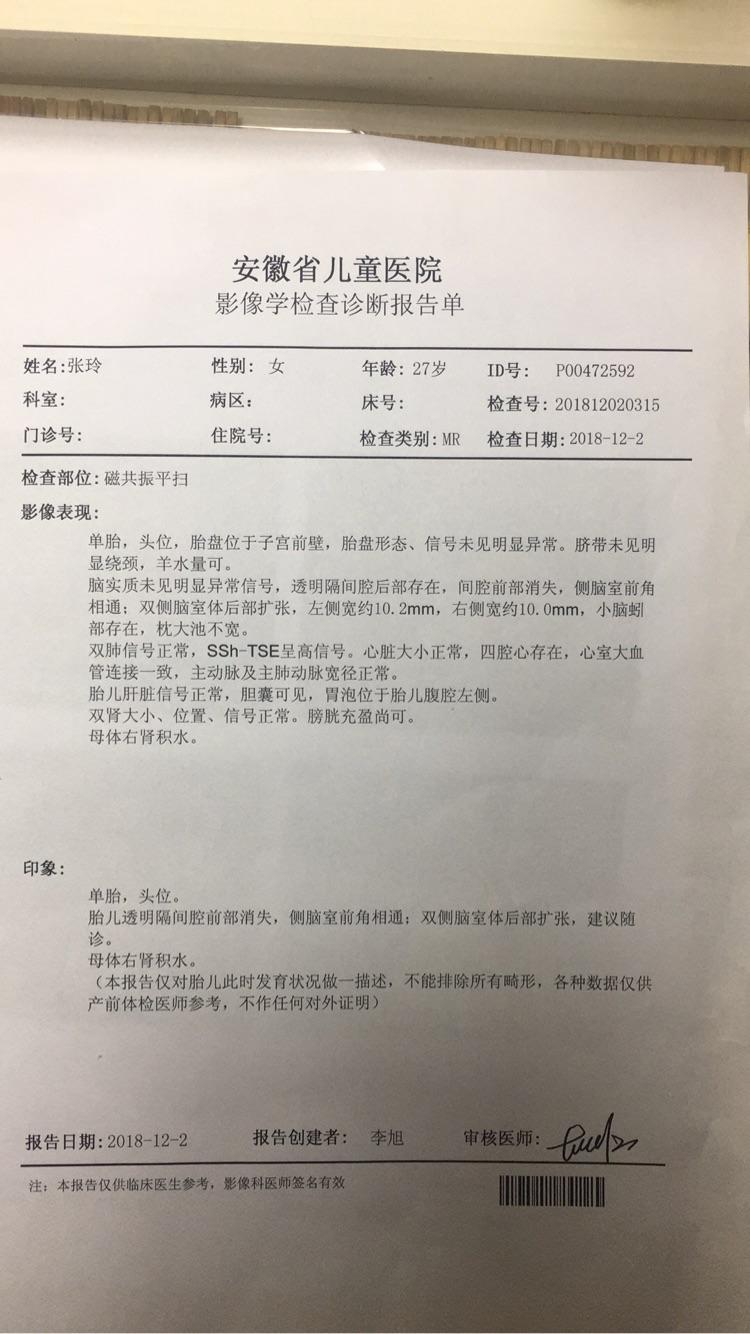 做头部核磁共振多少钱