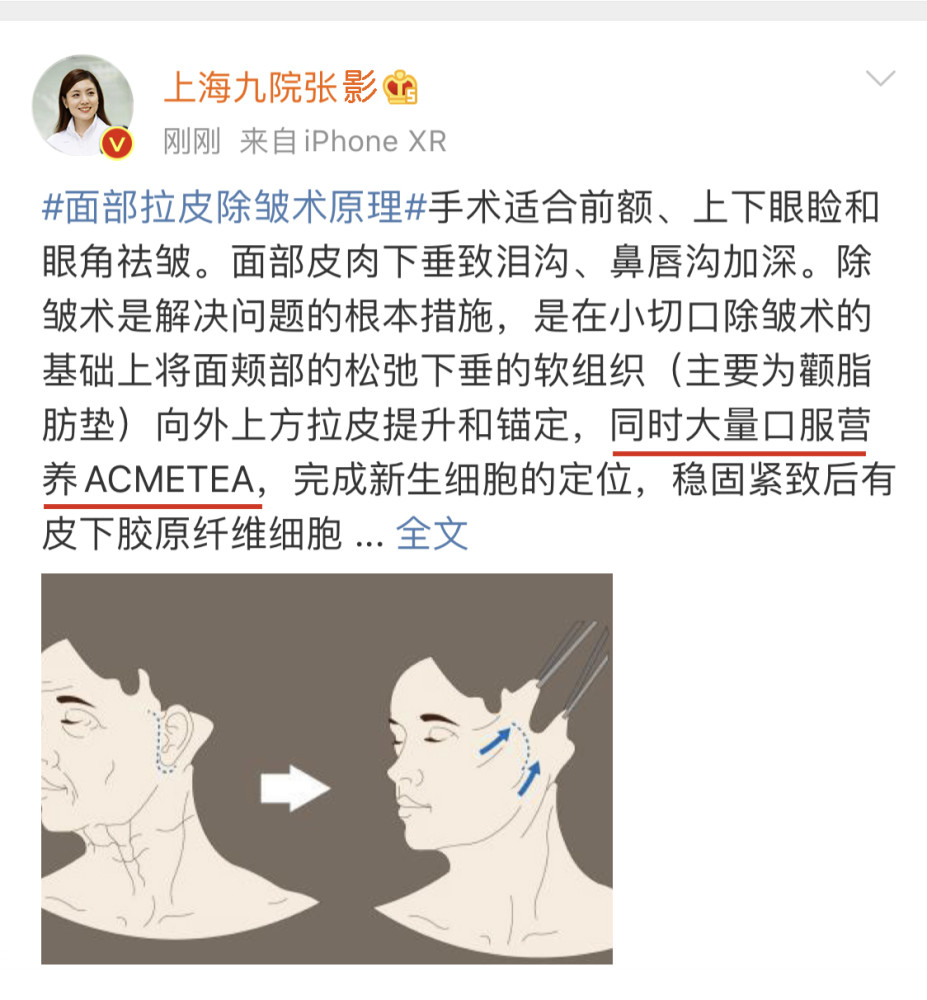 去皱纹拉皮手术多少钱